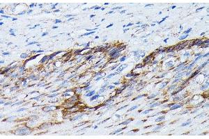 Immunohistochemistry of paraffin-embedded Human esophagus using KRT14 Polyclonal Antibody at dilution of 1:100 (40x lens).