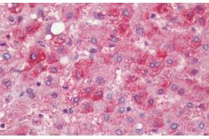Human, Liver: Formalin-Fixed Paraffin-Embedded (FFPE)