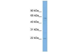 FTO antibody used at 1 ug/ml to detect target protein. (FTO anticorps  (Middle Region))