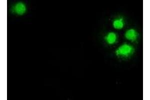 Anti-CHEK2 mouse monoclonal antibody (ABIN2452258) immunofluorescent staining of COS7 cells transiently transfected by pCMV6-ENTRY CHEK2 (RC201278).