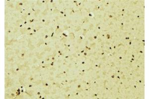 ABIN6276552 at 1/100 staining Mouse brain tissue by IHC-P. (IRF5 anticorps  (C-Term))