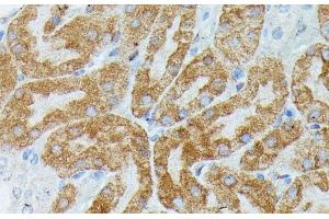 Immunohistochemistry of paraffin-embedded Mouse kidney using MEF2C Polyclonal Antibody at dilution of 1:100 (40x lens). (MEF2C anticorps)
