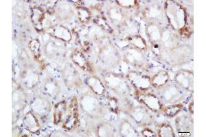 Formalin-fixed and paraffin embedded human kidney labeled with Rabbit Anti-NNT Polyclonal Antibody, Unconjugated  at 1:200 followed by conjugation to the secondary antibody and DAB staining (NNT anticorps  (AA 981-1086))