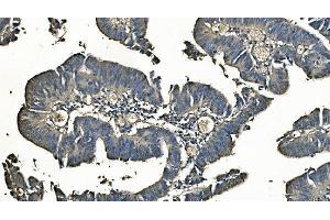 IHC analysis of Carbonic Anhydrase I/CA1 using anti-Carbonic Anhydrase I/CA1 antibody (ABIN7602621). (CA1 anticorps  (AA 9-261))