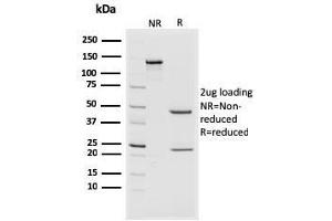 SDS-PAGE Analysis Purified CD44v4/5 Mouse Monoclonal Antibody (3D2). (CD44 anticorps)