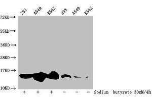 Western Blot Detected samples: 293 whole cell lysate, A549 whole cell lysate, K562 whole cell lysate, Untreated (-) or treated (+) with 30 mM sodium butyrate for 4h All lanes: HIST1H2BC antibody at 1:100 Secondary Goat polyclonal to rabbit IgG at 1/50000 dilution Predicted band size: 14 kDa Observed band size: 14 kDa (Histone H2B anticorps  (acLys20))