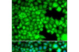 Immunofluorescence analysis of U2OS cells using FABP3 Polyclonal Antibody (FABP3 anticorps)