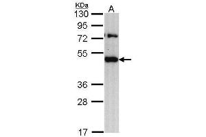 WB Image Sample (30 ug of whole cell lysate) A: H1299 10% SDS PAGE antibody diluted at 1:1000 (TRAM1 anticorps  (C-Term))