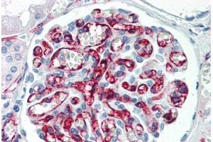 Human Kidney (formalin-fixed, paraffin-embedded) stained with PECAM1 antibody ABIN337092 at 5 ug/ml followed by biotinylated anti-mouse IgG secondary antibody ABIN481714, alkaline phosphatase-streptavidin and chromogen. (CD31 anticorps)