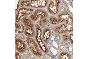 Immunohistochemical staining of human kidney with ASB8 polyclonal antibody  show strong cytoplasmic positivity in cells in tubules. (ASB8 anticorps)