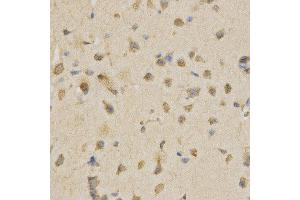 Immunohistochemistry (IHC) image for anti-Cell Division Cycle 34 (CDC34) antibody (ABIN1876645)