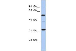 WB Suggested Anti-MGC51025 Antibody Titration: 0. (TBC1D26 anticorps  (Middle Region))