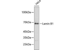 Western blot analysis of extracts of HeLa cells, using Lamin B1 antibody (ABIN1513160, ABIN3023296 and ABIN3023297). (Lamin B1 anticorps)