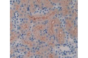 IHC-P analysis of kidney tissue, with DAB staining. (SPTLC3 anticorps  (AA 80-563))