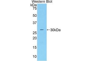 Western blot analysis of the recombinant protein. (Adipsin anticorps  (AA 1-263))