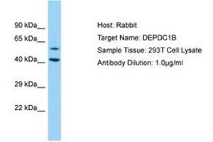 Image no. 1 for anti-DEP Domain Containing 1B (DEPDC1B) (AA 87-136) antibody (ABIN6750177) (DEPDC1B anticorps  (AA 87-136))