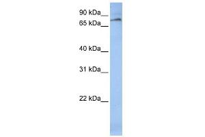 WB Suggested Anti-ALOX12 Antibody Titration: 0. (ALOX12 anticorps  (C-Term))