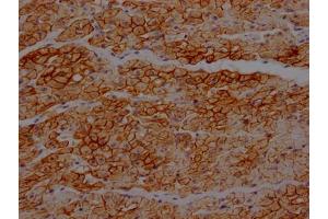 IHC image of ABIN7127460 diluted at 1:100 and staining in paraffin-embedded human heart tissue performed on a Leica BondTM system.