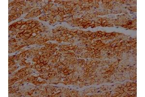 IHC image of ABIN7127460 diluted at 1:100 and staining in paraffin-embedded human heart tissue performed on a Leica BondTM system. (Recombinant Dystrophin anticorps)