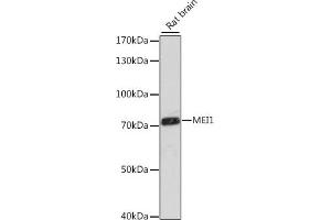 Western blot analysis of extracts of rat brain, using MEI1 antibody (ABIN7268447) at 1:1000 dilution. (MEI1 anticorps  (AA 1000-1170))