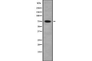 Western blot analysis of PAK5/6 using COLO whole cell lysates (PAK7 anticorps  (C-Term))
