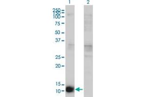 Western Blot analysis of CSTB expression in transfected 293T cell line by CSTB monoclonal antibody (M02), clone M2-F1.