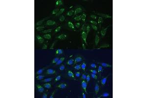 Immunofluorescence analysis of U-2 OS cells using COX6 Polyclonal Antibody (ABIN6132108, ABIN6138915, ABIN6138916 and ABIN6220368) at dilution of 1:100 (40x lens). (COX6A1 anticorps  (AA 25-109))