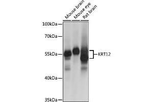 Western blot analysis of extracts of various cell lines, using KRT12 antibody (ABIN6134130) at 1:1000 dilution. (KRT12 anticorps  (AA 295-494))