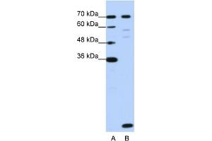 WB Suggested Anti-LSM2 Antibody Titration:  1. (LSM2 anticorps  (Middle Region))
