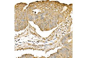Immunohistochemistry of paraffin-embedded mouse kidney using DNA Ligase III/LIG3 Rabbit pAb (ABIN6130288, ABIN6143207, ABIN6143208 and ABIN6217532) at dilution of 1:50 (40x lens).