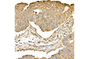 Immunohistochemistry of paraffin-embedded mouse kidney using DNA Ligase III/LIG3 Rabbit pAb (ABIN6130288, ABIN6143207, ABIN6143208 and ABIN6217532) at dilution of 1:50 (40x lens). (LIG3 anticorps  (AA 730-1009))