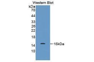 Western blot analysis of the recombinant protein. (MUC2 anticorps  (AA 5075-5179))