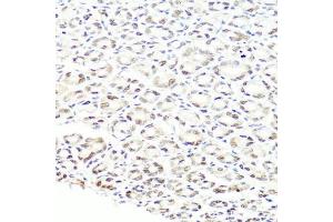 Immunohistochemistry of paraffin-embedded mouse stomach using PRPF8 antibody (ABIN5973594) at dilution of 1/100 (40x lens). (PRPF8 anticorps)