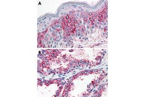 Immunohistochemical staining of formalin-fixed, paraffin-embedded human prostate (A) and human prostate (B) tissue after heat-induced antigen retrieval. (HTR2A anticorps  (N-Term))