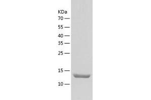 Western Blotting (WB) image for T Cell Receptor Associated Transmembrane Adaptor 1 (TRAT1) (AA 29-186) protein (His tag) (ABIN7125304)