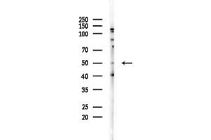 anti-Myocyte Enhancer Factor 2C (MEF2C) (C-Term) antibody