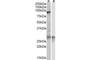 Western Blotting (WB) image for anti-Acetyl LDL Receptor (SCARF1) (Internal Region) antibody (ABIN2466320)