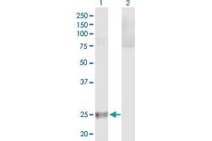 Western Blot analysis of HLA-DQB2 expression in transfected 293T cell line by HLA-DQB2 MaxPab polyclonal antibody.