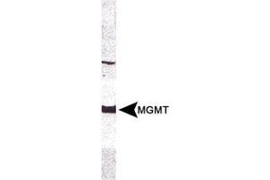 Western blot analysis of MGMT in CEM whole cell extract using MGMT monoclonal antibody, clone MT 23. (MGMT anticorps)