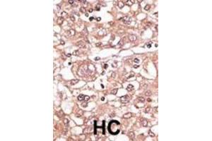 Immunohistochemistry (IHC) image for anti-Toll-Like Receptor 7 (TLR7) antibody (ABIN2998417)