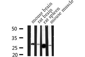 Western blot analysis of MBL2 expression in various lysates (MBL2 anticorps  (N-Term))