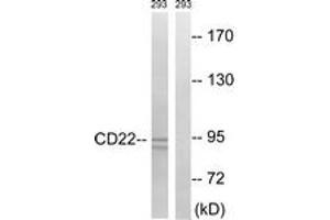 Western blot analysis of extracts from 293 cells, treated with Ca2+ 40nM 30', using BL-CAM (Ab-807) Antibody. (CD22 anticorps  (AA 776-825))