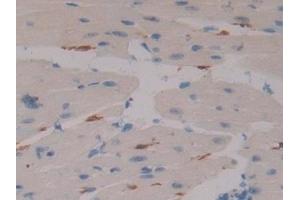 Detection of F13A1 in Mouse Heart Tissue using Polyclonal Antibody to Coagulation Factor XIII A1 Polypeptide (F13A1)