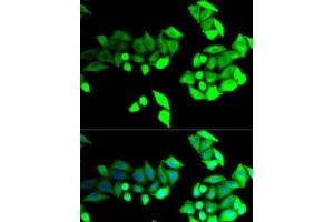 Immunofluorescence analysis of U2OS cells using BEST1 Polyclonal Antibody (Bestrophin 1 anticorps)