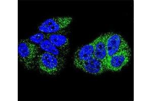 Confocal immunofluorescent analysis of HNF4A antibody with MCF-7 cells followed by Alexa Fluor 488-conjugated goat anti-rabbit lgG (green).