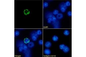 Immunofluorescence staining of mouse splenocytes using anti-MHC I antibody R1-21. (Recombinant MHC, Class I anticorps)