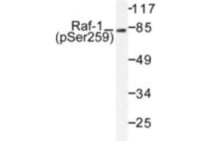 Image no. 1 for anti-V-Raf-1 Murine Leukemia Viral Oncogene Homolog 1 (RAF1) (pSer259) antibody (ABIN318109) (RAF1 anticorps  (pSer259))