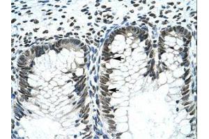 Image no. 3 for anti-GLI Family Zinc Finger 2 (GLI2) (AA 600-649) antibody (ABIN202982)