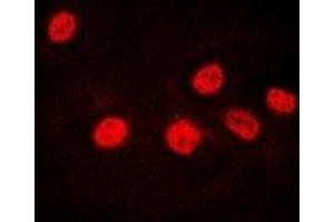 Immunofluorescent analysis of Ikaros staining in U2OS cells. (IKZF1 anticorps)