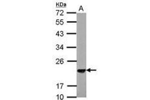 Image no. 2 for anti-S-Phase Kinase-Associated Protein 1 (SKP1) (AA 1-163) antibody (ABIN1500944) (SKP1 anticorps  (AA 1-163))